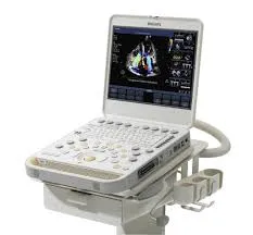 Philips CX50 ultrasound system